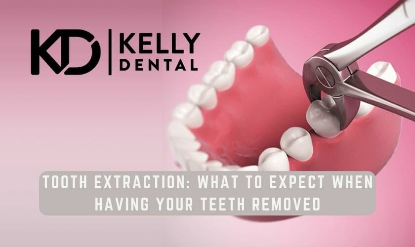 Tooth Extraction in Springfield