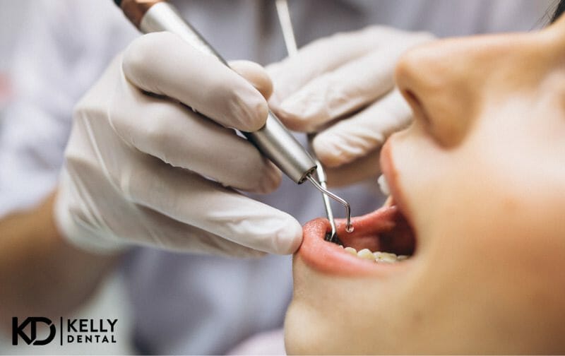 Periodontal Treatment in Springfield